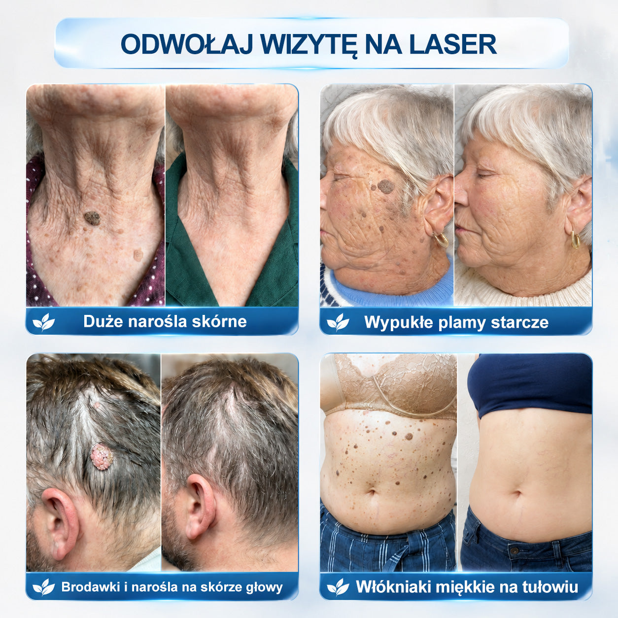🏥🛒 𝐏i𝐜𝐝o® 7 𝑫𝒏𝒊 𝑷𝒓𝒆𝒑𝒂𝒓𝒂𝒕 𝑫𝒐 𝑼𝒔𝒖𝒘𝒂𝒏𝒊𝒂 𝑾łó𝒌𝒏𝒊𝒂𝒌ó𝒘 𝑴𝒊ę𝒌𝒌𝒊𝒄𝒉 𝑰 𝑷𝒓𝒛𝒆𝒃𝒂𝒓𝒘𝒊𝒆ń(𝐁𝐞𝐳 𝐁ó𝐥𝐮, 𝐁𝐞𝐳 𝐁𝐥𝐢𝐳𝐧 – 𝐑𝐨𝐥𝐥-𝐨𝐧)