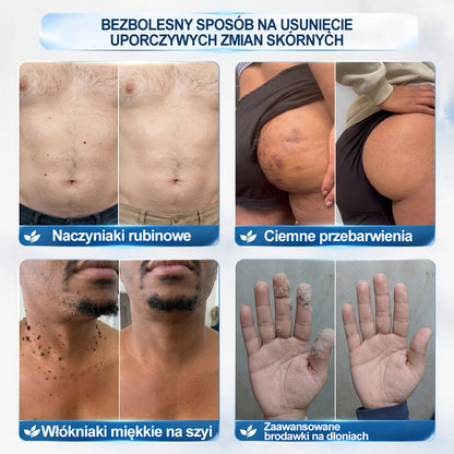 🏥🛒 𝐏i𝐜𝐝o® 7 𝑫𝒏𝒊 𝑷𝒓𝒆𝒑𝒂𝒓𝒂𝒕 𝑫𝒐 𝑼𝒔𝒖𝒘𝒂𝒏𝒊𝒂 𝑾łó𝒌𝒏𝒊𝒂𝒌ó𝒘 𝑴𝒊ę𝒌𝒌𝒊𝒄𝒉 𝑰 𝑷𝒓𝒛𝒆𝒃𝒂𝒓𝒘𝒊𝒆ń(𝐁𝐞𝐳 𝐁ó𝐥𝐮, 𝐁𝐞𝐳 𝐁𝐥𝐢𝐳𝐧 – 𝐑𝐨𝐥𝐥-𝐨𝐧)