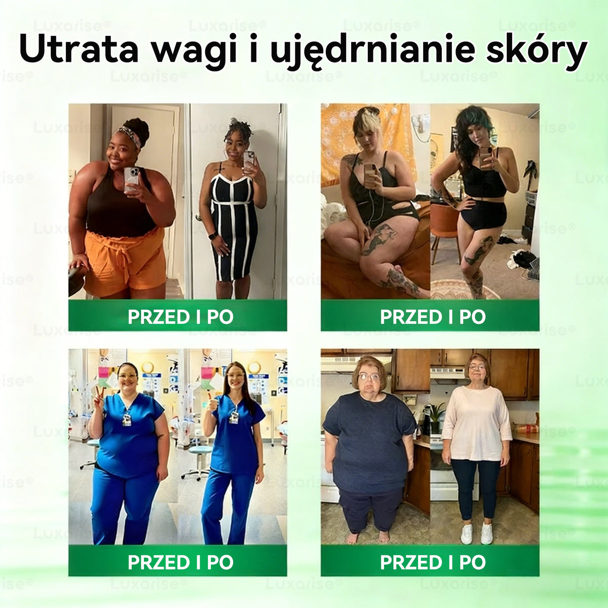 𝑶𝒇𝒊𝒄𝒋𝒂𝒍𝒏𝒚 𝑺𝒌𝒍𝒆𝒑  | 👩‍⚕️ 🐌𝑳𝒖𝒙𝒂𝒓𝒊𝒔𝒆® 𝑴𝒐𝒓𝒊𝒏𝒈𝒂 𝒛 𝒃𝒆𝒓𝒃𝒆𝒓𝒚𝒏ą 10 𝑾 1 𝒁𝒂𝒂𝒘𝒂𝒏𝒔𝒐𝒘𝒂𝒏𝒚 𝑵𝒂𝒏𝒐-𝑴𝒊𝒌𝒓𝒐𝒊𝒈ł𝒐𝒘𝒚 𝑷𝒍𝒂𝒔𝒕𝒆𝒓𝑹𝒂𝒛 𝒅𝒛𝒊𝒆𝒏𝒏𝒊𝒆 – 𝒘𝒊𝒅𝒐𝒄𝒛𝒏𝒆 𝒛𝒎𝒊𝒂𝒏𝒚 𝒋𝒖ż 𝒘 7 𝒅𝒏𝒊 ✅ 𝑶𝒕𝒚ł𝒐ść, 𝒄𝒖𝒌𝒓𝒛𝒚𝒄𝒂, 𝒃𝒆𝒛𝒅𝒆𝒄𝒉 𝒔𝒆𝒏𝒏𝒚 𝒐𝒓𝒂𝒛 𝒑𝒓𝒐𝒃𝒍𝒆𝒎𝒚 𝒛𝒆 𝒔𝒕𝒂𝒘𝒂𝒎𝒊