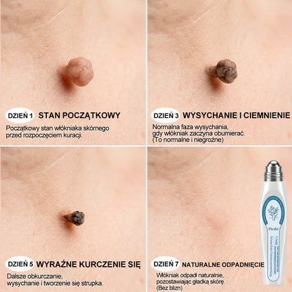 🏥🛒 𝐏i𝐜𝐝o® 7 𝑫𝒏𝒊 𝑷𝒓𝒆𝒑𝒂𝒓𝒂𝒕 𝑫𝒐 𝑼𝒔𝒖𝒘𝒂𝒏𝒊𝒂 𝑾łó𝒌𝒏𝒊𝒂𝒌ó𝒘 𝑴𝒊ę𝒌𝒌𝒊𝒄𝒉 𝑰 𝑷𝒓𝒛𝒆𝒃𝒂𝒓𝒘𝒊𝒆ń(𝐁𝐞𝐳 𝐁ó𝐥𝐮, 𝐁𝐞𝐳 𝐁𝐥𝐢𝐳𝐧 – 𝐑𝐨𝐥𝐥-𝐨𝐧)