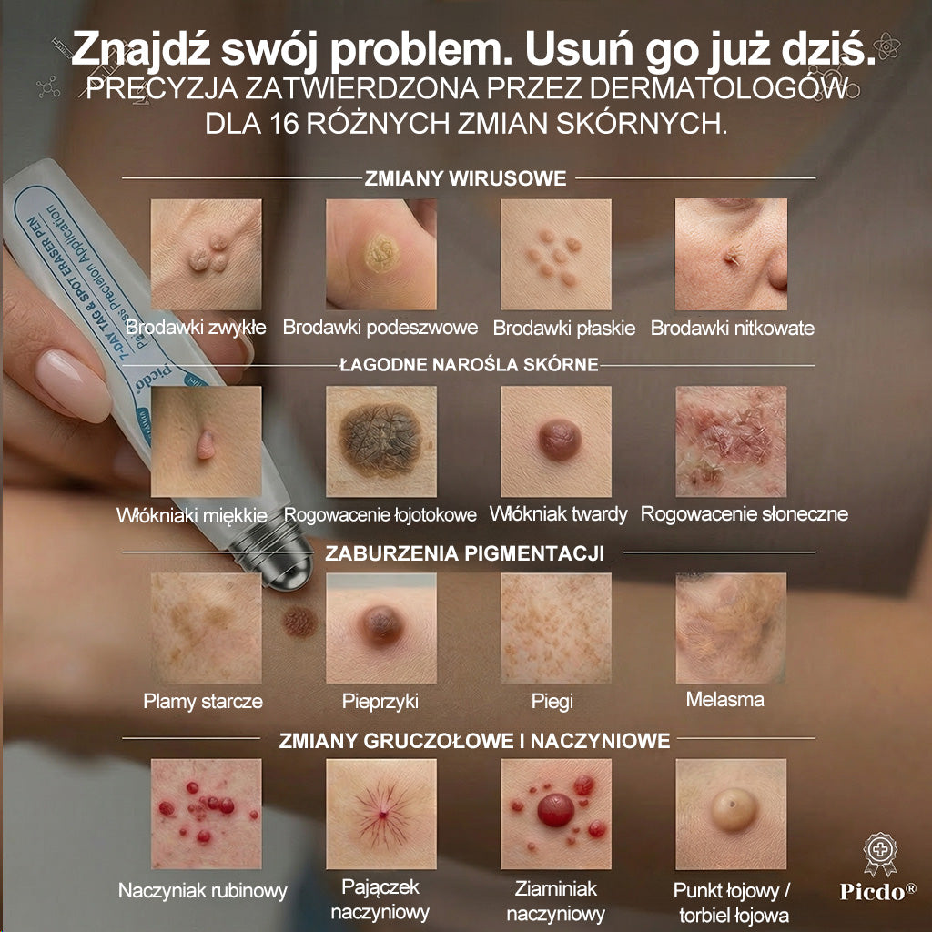 🏥🛒 𝐏i𝐜𝐝o® 7 𝑫𝒏𝒊 𝑷𝒓𝒆𝒑𝒂𝒓𝒂𝒕 𝑫𝒐 𝑼𝒔𝒖𝒘𝒂𝒏𝒊𝒂 𝑾łó𝒌𝒏𝒊𝒂𝒌ó𝒘 𝑴𝒊ę𝒌𝒌𝒊𝒄𝒉 𝑰 𝑷𝒓𝒛𝒆𝒃𝒂𝒓𝒘𝒊𝒆ń(𝐁𝐞𝐳 𝐁ó𝐥𝐮, 𝐁𝐞𝐳 𝐁𝐥𝐢𝐳𝐧 – 𝐑𝐨𝐥𝐥-𝐨𝐧)